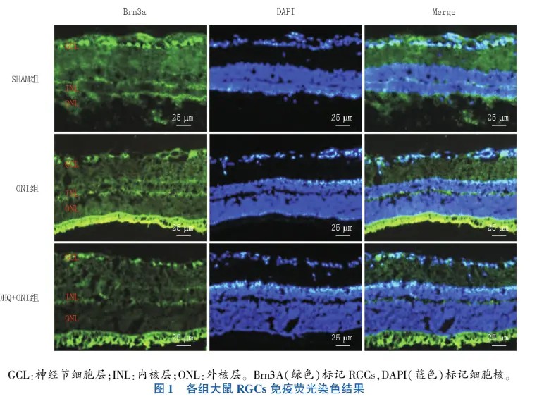 Immunofluorescence staining results of RGCs in each group of rats Immunofluorescence staining results of RGCs in each group of rats